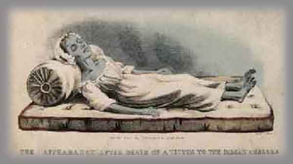 Cholera victim